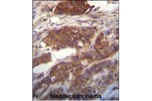 Immunohistochemistry (Paraffin-embedded Sections) (IHC (p)) image for anti-Ubiquitin-Fold Modifier Conjugating Enzyme 1 (UFC1) (C-Term) antibody (ABIN650703)
