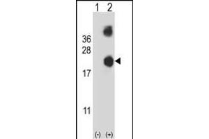 Western blot analysis of DSTN (arrow) using rabbit polyclonal DSTN Antibody (Center) (ABIN653136 and ABIN2842712).
