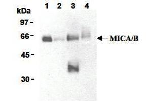 Western Blotting (WB) image for anti-MHC Class I Polypeptide-Related Sequence A (MICA) antibody (ABIN1108244) (MICA Antikörper)
