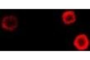 Immunofluorescent analysis of Epsilon-sarcoglycan staining in Hela cells.