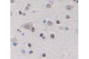 IHC-P analysis of Human Tissue, with DAB staining. (DYRK1A Antikörper  (AA 16-300))