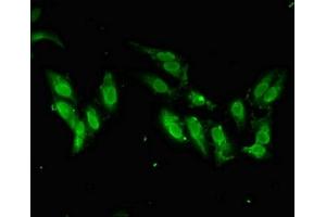 Immunofluorescence (IF) image for anti-SWI/SNF Related, Matrix Associated, Actin Dependent Regulator of Chromatin, Subfamily A-Like 1 (SMARCAL1) (AA 6-277) antibody (ABIN7171062)