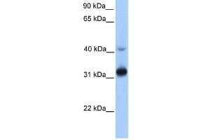 GPSN2 antibody used at 1 ug/ml to detect target protein. (TECR Antikörper  (Middle Region))