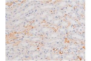 ABIN6267364 at 1/200 staining Rat kidney tissue sections by IHC-P. (KIT Antikörper  (pTyr703))