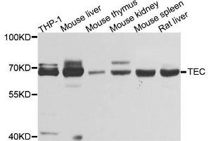 Western blot analysis of extracts of various cell lines, using TEC antibody. (NR4A3 Antikörper  (AA 1-280))