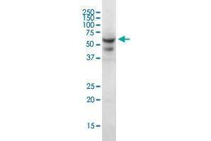 Western Blotting (WB) image for anti-Carnitine O-Acetyltransferase (CRAT) (AA 445-544) antibody (ABIN560457)