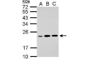 WB Image Sample (30 ug of whole cell lysate) A: Jurkat B: Raji C: K562 12% SDS PAGE antibody diluted at 1:1000 (RPL17P7 Antikörper  (Center))