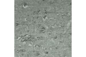 IHC on mouse brain (cryo section) using Rabbit antibody to Synaptotagmin 17  at a concentration of 50 µg/ml incubated overnight at 4C. (SYT17 Antikörper  (Internal Region))