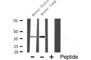 Western Blotting (WB) image for anti-Synaptophysin (SYP) (Internal Region) antibody (ABIN6265394)