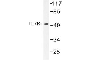 Image no. 1 for anti-Interleukin 7 Receptor (IL7R) antibody (ABIN317658) (IL7R Antikörper)
