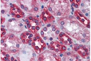 Human Kidney: Formalin-Fixed, Paraffin-Embedded (FFPE) (Calnexin Antikörper  (AA 204-218))