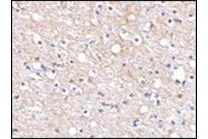 Immunohistochemical staining of human brain tissue using AP30680PU-N at 2. (PLXDC2 Antikörper  (N-Term))