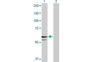 Western Blot analysis of CYP11A1 expression in transfected 293T cell line by CYP11A1 MaxPab polyclonal antibody. (CYP11A1 Antikörper  (AA 1-521))