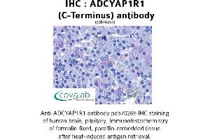 Image no. 1 for anti-Adenylate Cyclase Activating Polypeptide 1 (Pituitary) Receptor Type I (ADCYAP1R1) (C-Term) antibody (ABIN1731539) (ADCYAP1R1 Antikörper  (C-Term))