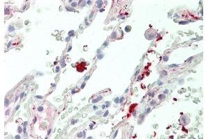 Immunohistochemistry (IHC) image for anti-Wingless-Type MMTV Integration Site Family, Member 11 (WNT11) (Middle Region) antibody (ABIN2776712)