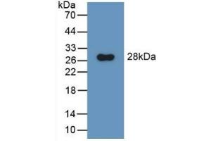 Detection of Recombinant GluAP, Rat using Polyclonal Antibody to Aminopeptidase A (ENPEP) (ENPEP Antikörper  (AA 409-624))