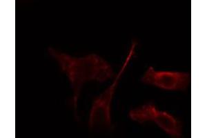 ABIN6274242 staining HepG2 cells by IF/ICC. (ADRBK2 Antikörper  (Internal Region))