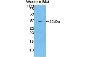 Western blot analysis of the recombinant protein. (PDK4 Antikörper  (AA 117-387))
