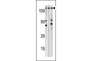 Western blot analysis of anti-CSE1L Pab (ABIN1882070 and ABIN2838356) in, from left to right, , CEM, and mouse heart cell line lysates (35 μg/lane). (CSE1L Antikörper  (N-Term))