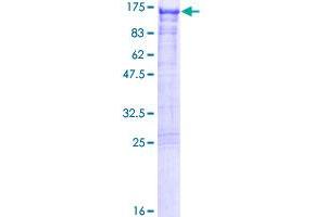 SAPS2 Protein (AA 1-932) (GST tag)