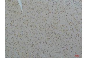 Immunohistochemistry (IHC) analysis of paraffin-embedded Mouse Brain Tissue using Cav pan alpha1 Rabbit Polyclonal Antibody diluted at 1:200. (Cav Pan Alpha1 (pan) Antikörper)