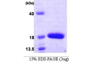 SDS-PAGE (SDS) image for Chromosome 19 Open Reading Frame 10 (C19orf10) (AA 33-173) protein (His tag) (ABIN666880)
