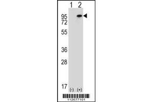 Western blot analysis of WHSC1L1 using rabbit polyclonal WHSC1L1 Antibody using 293 cell lysates (2 ug/lane) either nontransfected (Lane 1) or transiently transfected (Lane 2) with the WHSC1L1 gene.
