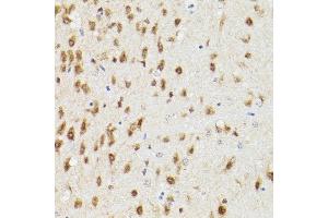 Immunohistochemistry of paraffin-embedded rat brain using PSM Rabbit pAb (ABIN3021834, ABIN3021835, ABIN3021836 and ABIN6216081) at dilution of 1:100 (40x lens). (PSMA3 Antikörper  (AA 1-255))