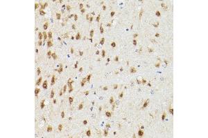 Immunohistochemistry (IHC) image for anti-Proteasome Subunit Alpha Type 3 (PSMA3) (AA 1-255) antibody (ABIN3021835)