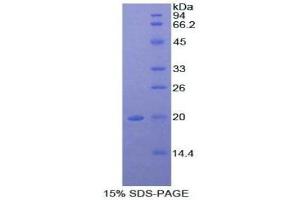 SDS-PAGE (SDS) image for alpha-2-Macroglobulin (A2M) (AA 1053-1214) protein (His tag) (ABIN2120521)