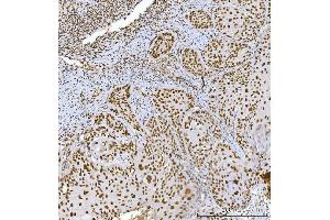 IHC analysis of RCC1 using anti-RCC1 antibody (ABIN7600022).