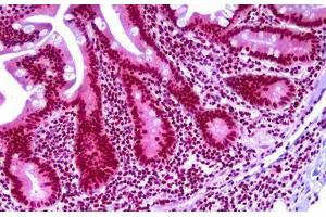 Anti-TARBP2 antibody IHC staining of human small intestine. (TARBP2 Antikörper)