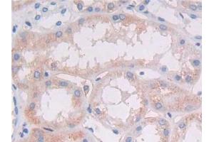 Immunohistochemistry (IHC) image for anti-Major Histocompatibility Complex, Class II, DR beta 1 (HLA-DRB1) (AA 30-266) antibody (ABIN7440764)