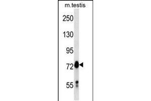 Western blot analysis in mouse testis tissue lysates (35ug/lane). (MARK4 Antikörper  (C-Term))