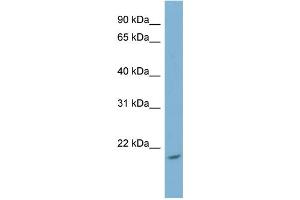 WB Suggested Anti-NME4 Antibody Titration: 0. (NME4 Antikörper  (Middle Region))