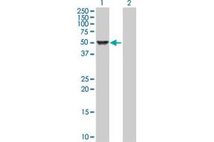 Western Blot analysis of CAMK4 expression in transfected 293T cell line by CAMK4 MaxPab polyclonal antibody. (CAMK4 Antikörper  (AA 1-473))