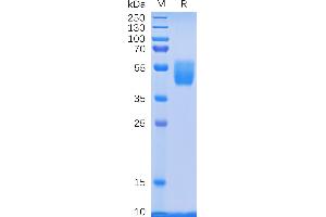 Human PSCA Protein, hFc Tag on SDS-PAGE under reducing condition.