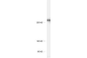 Western Blotting (WB) image for anti-Calcium Channel, Voltage-Dependent, N Type, alpha 1B Subunit (CACNA1B) (alpha-1E subunit) antibody (ABIN4889903)