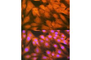 Immunofluorescence (IF) image for anti-Fibroblast Growth Factor 1 (Acidic) (FGF1) antibody (ABIN7267182)
