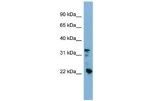 WB Suggested Anti-CRYBB3 Antibody Titration: 0. (CRYBB3 Antikörper  (Middle Region))