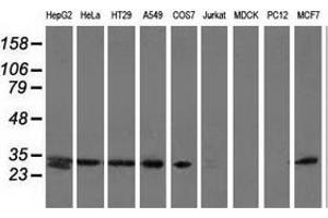 Western blot analysis of extracts (35 µg) from 9 different cell lines by using anti-SPR monoclonal antibody. (SPR Antikörper)