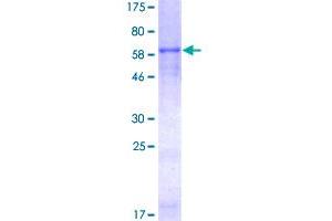 Image no. 1 for Chitinase 3-Like 1 (Cartilage Glycoprotein-39) (CHI3L1) (AA 1-383) protein (GST tag) (ABIN1349321)