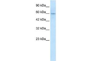WB Suggested Anti-GSK3A Antibody Titration:  1.