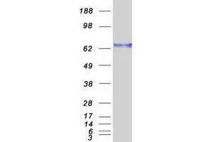 Validation with Western Blot