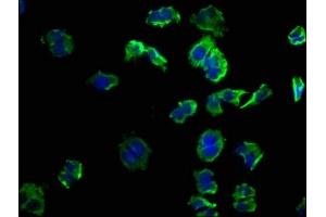 Immunofluorescence staining of PC-3 cells with ABIN7139863 at 1:50, counter-stained with DAPI. (GNG12 Antikörper  (AA 2-17))