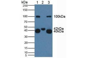 Figure. (CD161 Antikörper  (AA 73-188))