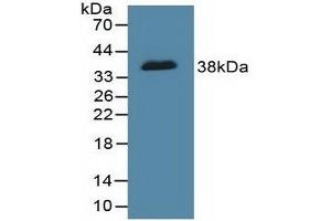 Detection of Recombinant DFFa, Human using Polyclonal Antibody to DNA Fragmentation Factor Subunit Alpha (DFFa)