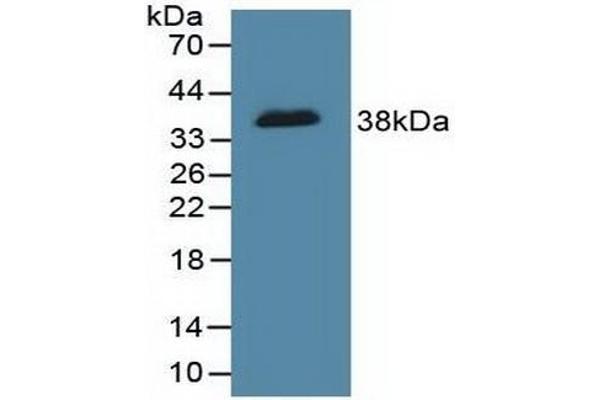 DFFA Antikörper  (AA 51-305)