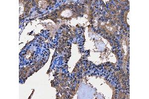 IHC analysis of SART3 using anti-SART3 antibody (ABIN7600151).