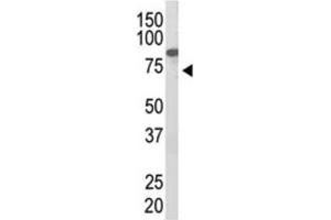 Western Blotting (WB) image for anti-Protein Inhibitor of Activated STAT, 2 (PIAS2) antibody (ABIN2996779) (PIAS2 Antikörper)